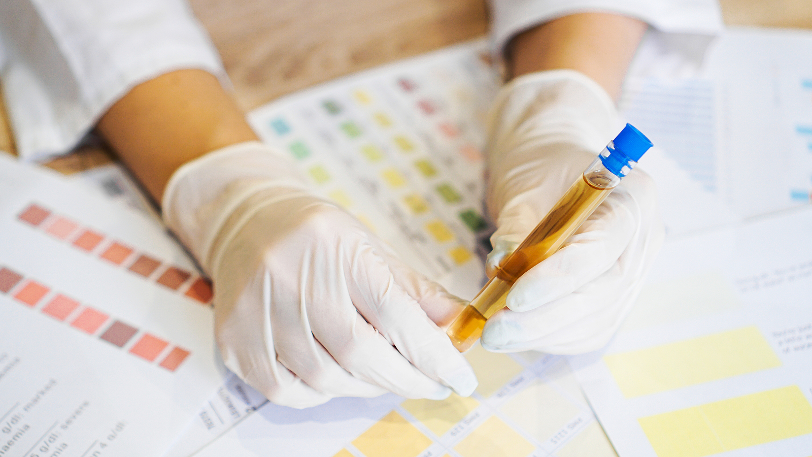 Woman checking healthy urine colour with ph material in laboratory